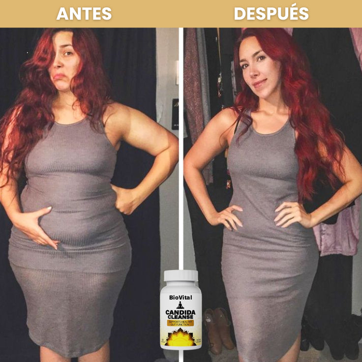 Candida Cleanse® Cápsulas que reducen antojos, hinchazón y fatiga